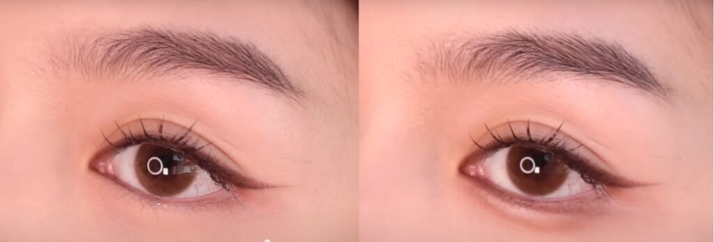 Korean Under Eyes Trend- Aegyosal